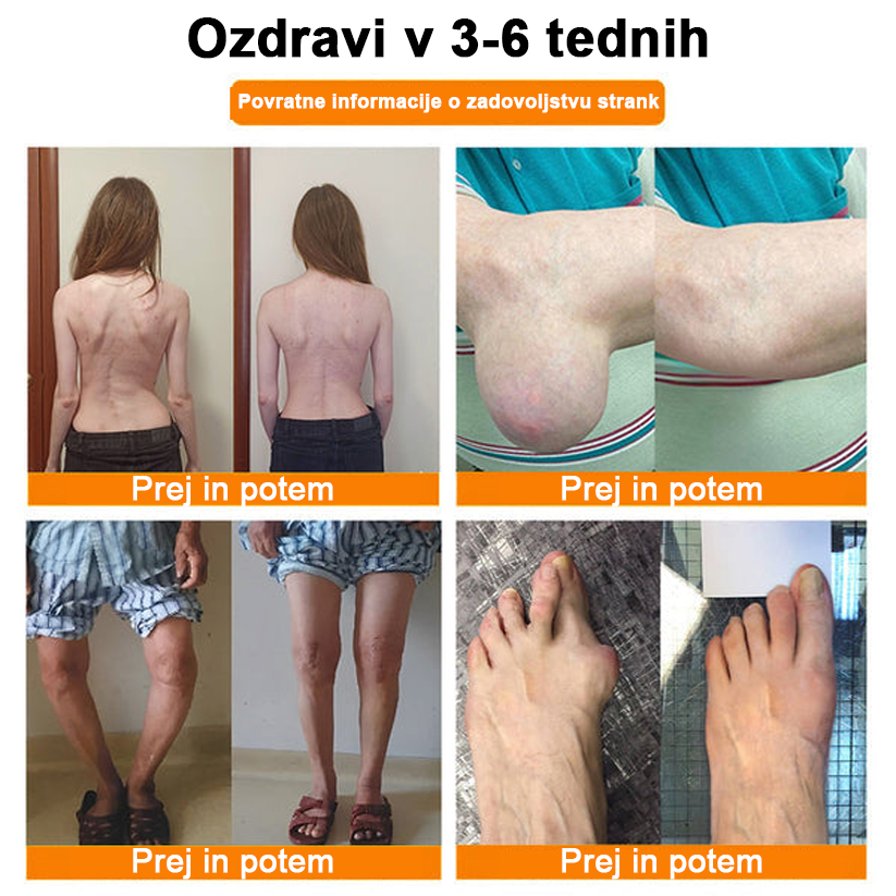 ✅Offizieller Shop: Ourlyard™ Magnezijevo olje & čebelji strup sprej za zdravljenje sklepov