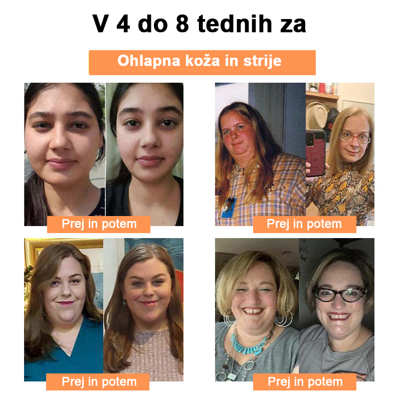 🍀🎈𝐅𝐑𝐎𝐏𝐔𝐍™ Čebelji strup Limfna drenaža obliž za hujšanje (Za vse limfatične težave in debelost)