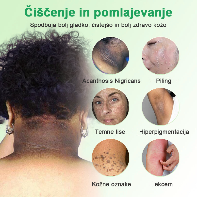 Čistilni piling gel za Acanthosis Nigricans, luščenje, temne madeže, kožne oznake in ekceme