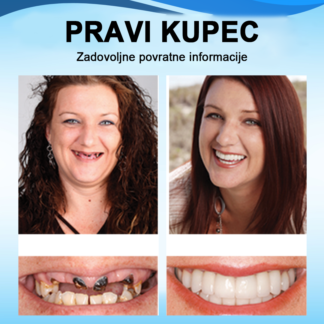 šššššā¢ set silikonskih reline proteza