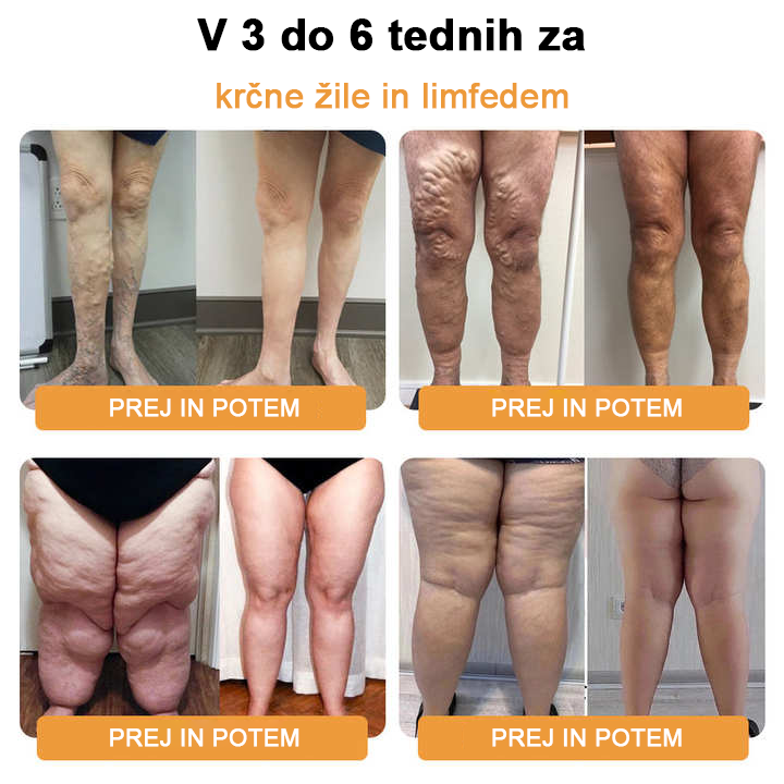 🔥𝙅𝙊𝙎𝙁𝙄𝙏™ Ultrazvočna zapestnica za razstrupljanje maščob in uravnavanje krvnega sladkorja z daljnim infrardečim sevanjem  🌸