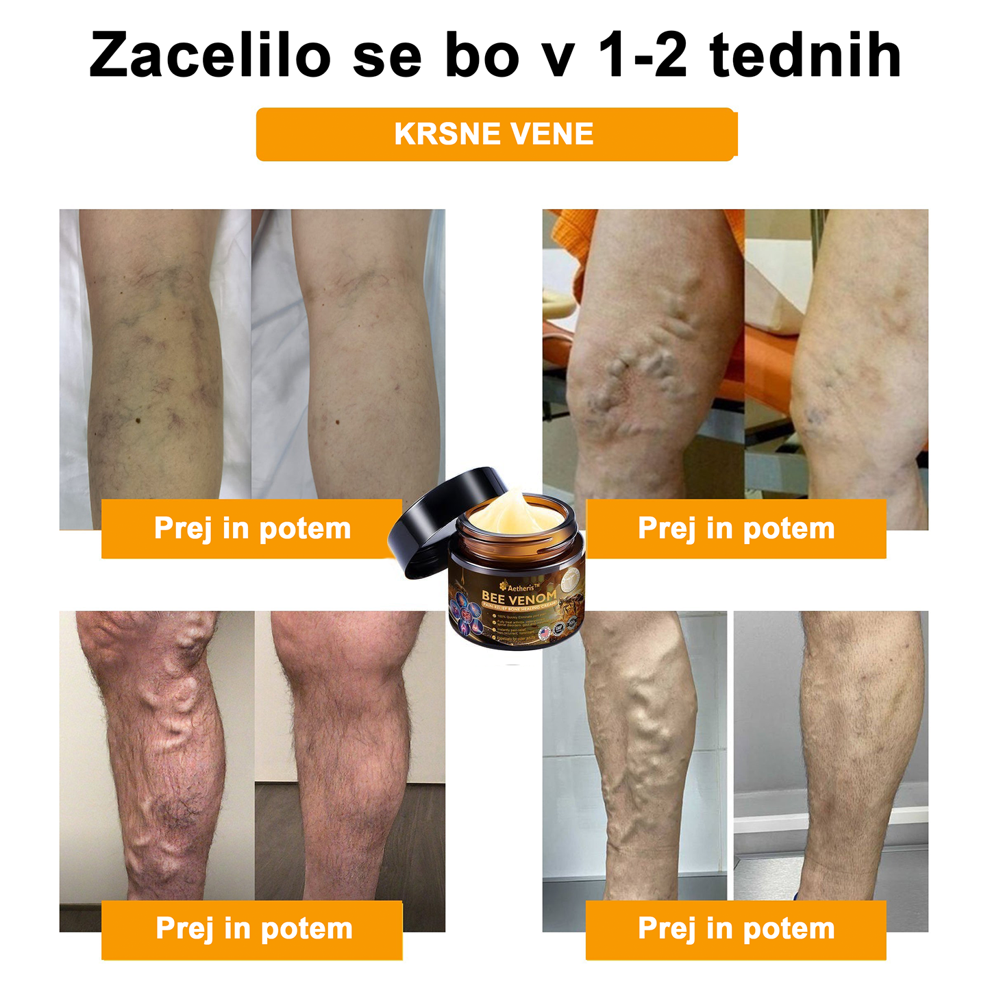 🔥 𝘈𝘦𝘵𝘩𝘦𝘳𝘪𝘴™ Krema za lajšanje artritisa s čebeljim strupom (posebej za starejše odrasle) 🦴– zadnji dan promocije: 70 % popusta 💪