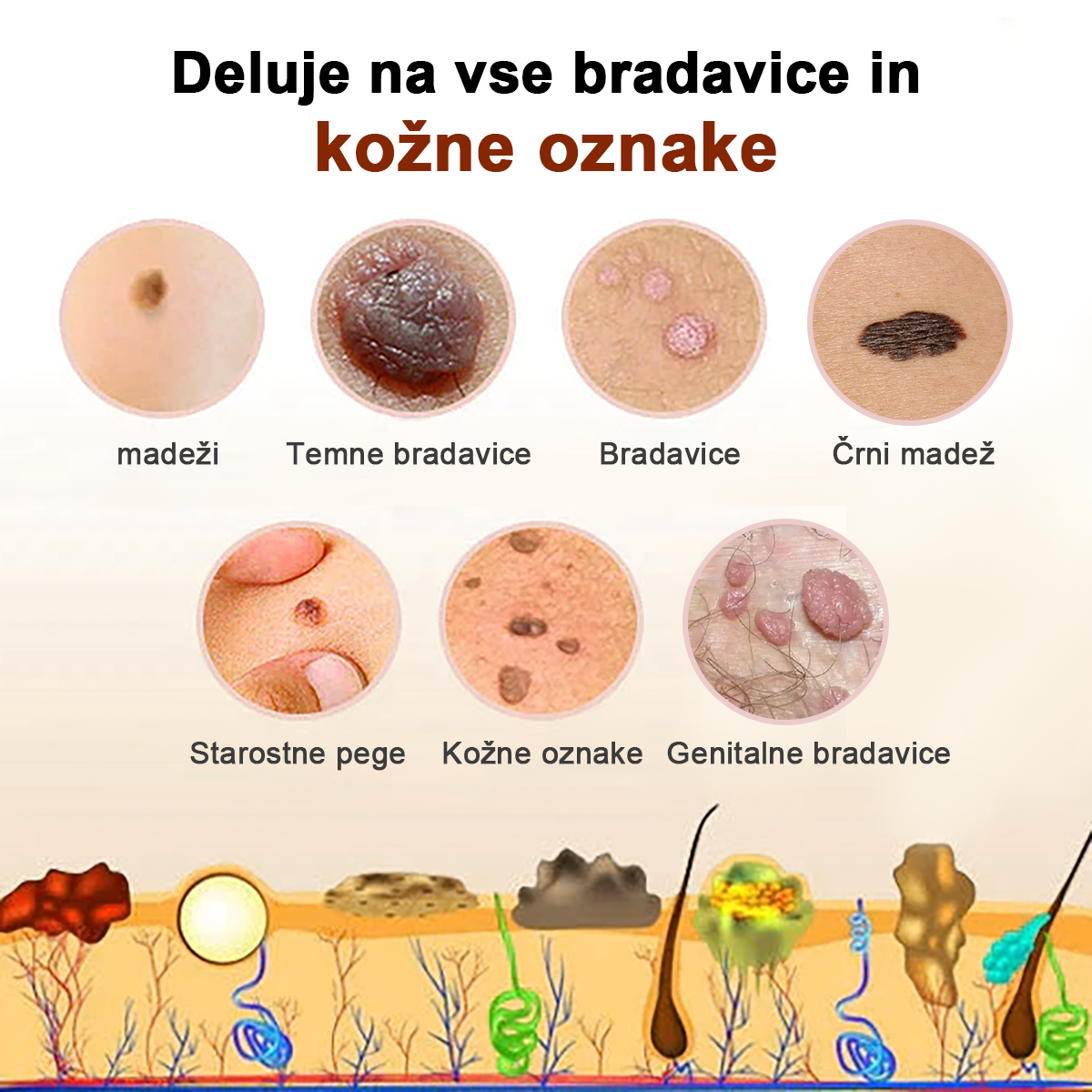 🐝 Krema Lenaro™ za zdravljenje madežev in bradavic 💎💎💎Primerna za vse starostne kategorije🐝