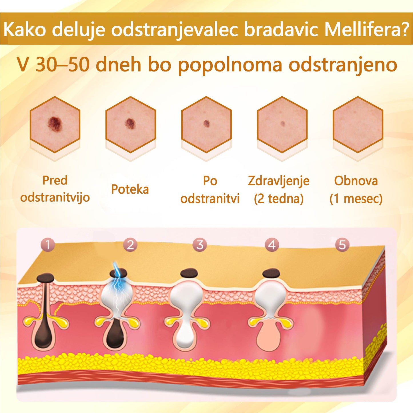 🌟 TOPWAL® Condense Krema za obnovo kože z čebeljim strupom 🌿 Spodbuja regeneracijo kože 💧 Globoko vlaži in neguje ✨ Zmanjšuje drobne gube in linije 🐝 Obogatena z naravnim čebeljim strupom ✔️ Primerna za vse tipe kože, tudi občutljivo