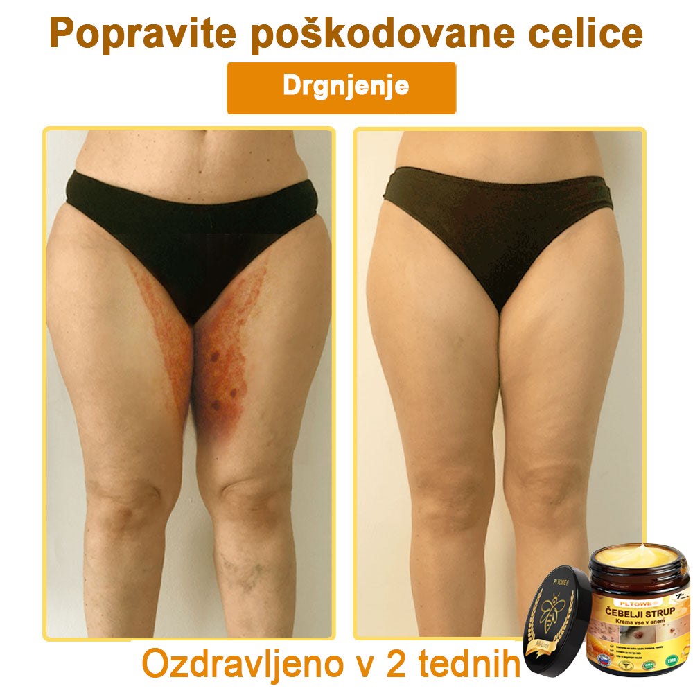 ZADNJA PRILOŽNOST! Zgrabi to srečno najdbo s 70 % Popustom! 🔥180-DNEVNO GARANCIJA VRAČILA DENARJA!