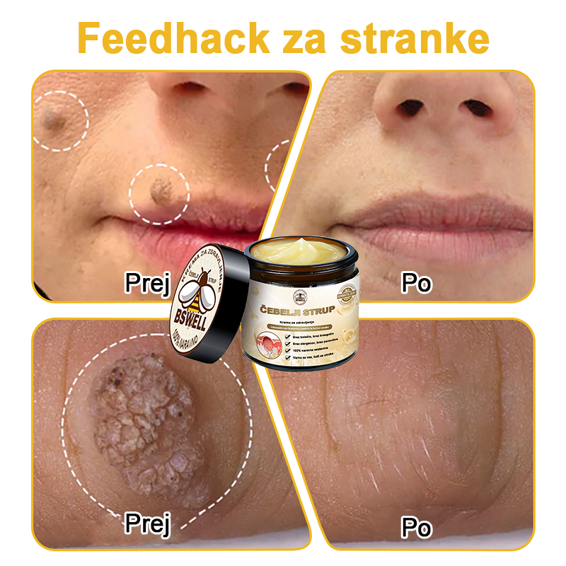 🐝✨𝑩𝑺𝑾𝑬𝑳𝑳® Krema za nego kože z čebeljim strupom👨⚕️ (Priporočena s strani AAD) (🔥 Zadnji dan promocije, prihranite 70%)