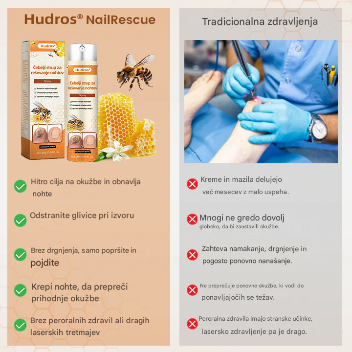 💥 2025 Omejeno 70 % CENEJE ️⏳ Ceoerty® NailRescue Kolirin pršilo proti glivicam s čebeljim strupom 💥 Vse težave z nohti lahko pozdravite v 2 tednih