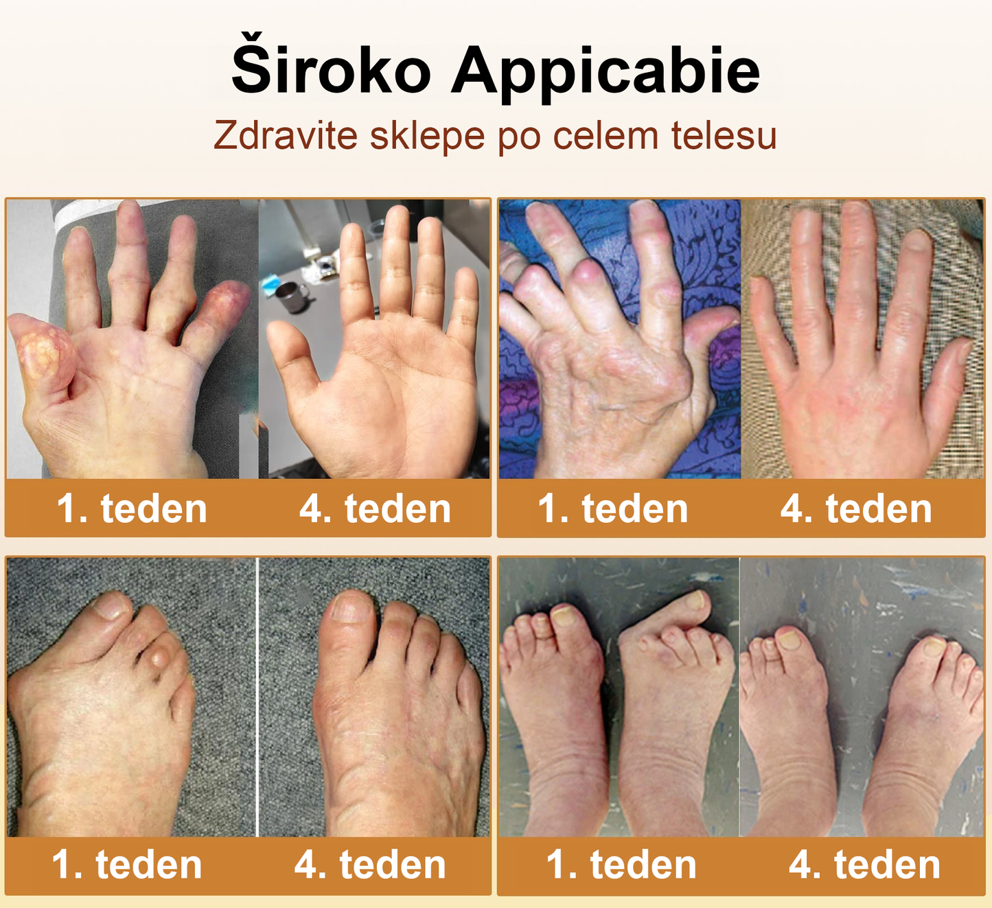 🌿TODAHOF™ Sprej za sklepe s čebeljim strupom💎Primeren za vse starosti🔥 Časovno omejen 75% popust