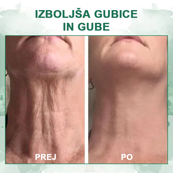 🌿Osvežite kožo v samo treh dneh💝𝙁𝙪𝙗𝙨𝙩𝙖™ pomlajevalni in učvrstitveni serum🔥