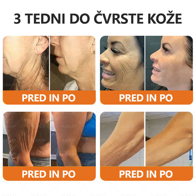 💟 Dermatologi priporočajo ✨ ZödVita® obnavljajoča krema z čebeljim strupom 🔥  CE-certifikat in ga priporoča Slovensko dermatološko društvo (SDD)