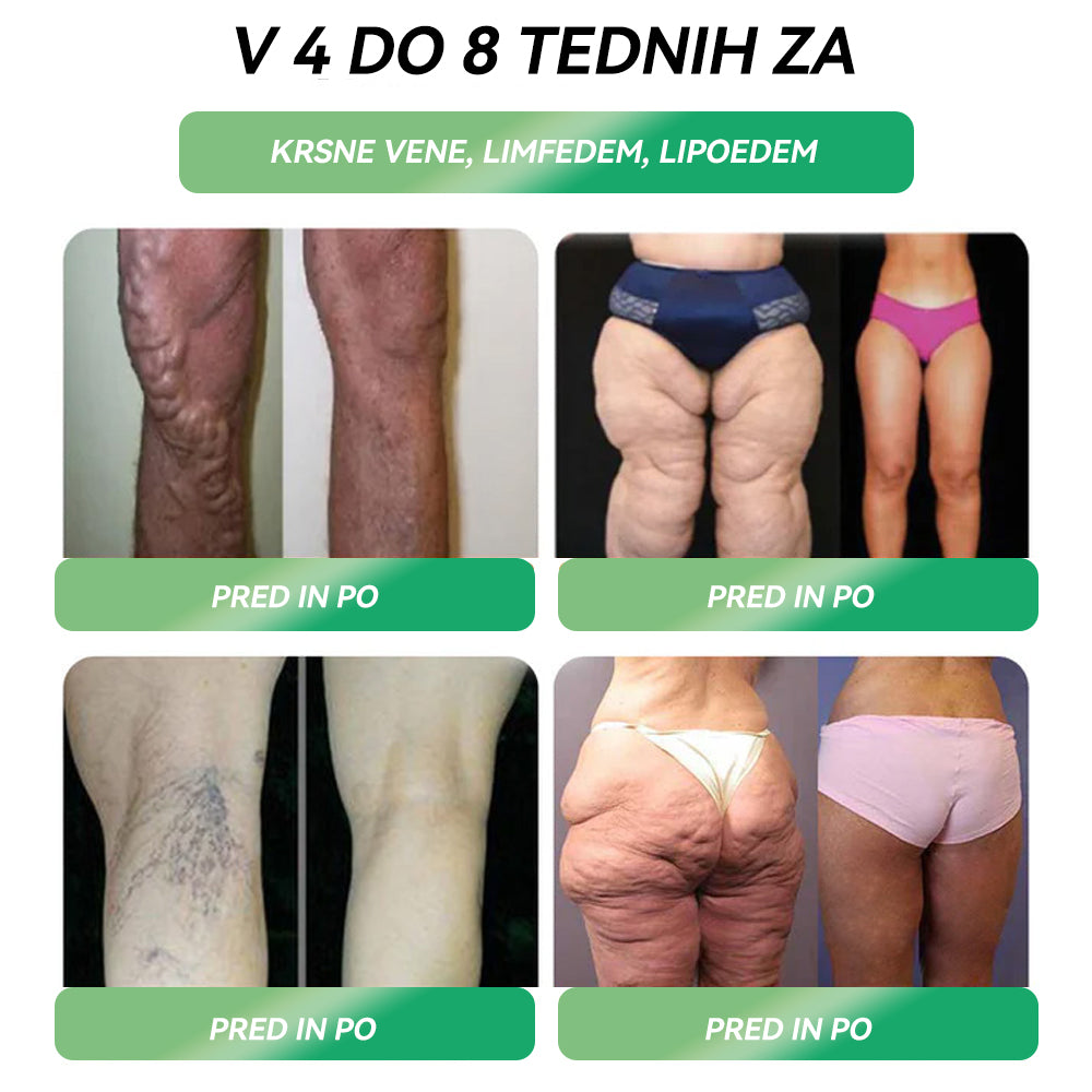 ✅Več kot 100.000 priporočil | Uradna trgovina | 𝑆𝑇𝐷𝐸𝐼® 💎💎💎 𝐺𝐿𝑃-1 𝐼𝑧𝑔𝑢𝑏𝑎 𝑇𝑒ž𝑒 𝑈𝑠𝑡𝑛𝑎 𝑅𝑒š𝑖𝑡𝑒𝑣 - Debelost, bolezni srca in ožilja, diabetes, spalna apneja, težave s sklepi in še več