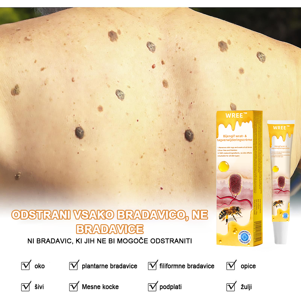 🌺𝙒𝙍𝙀𝙀™ Krema za odstranjevanje bradavic in oznak s čebeljim strupom (👨⚕Primerna za vse tipe kože)🐝(🔥Promocija zadnji dan 70% popust)