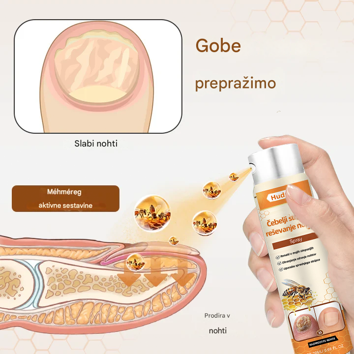 💥 2025 Omejeno 70 % CENEJE ️⏳ Ceoerty® NailRescue Kolirin pršilo proti glivicam s čebeljim strupom 💥 Vse težave z nohti lahko pozdravite v 2 tednih