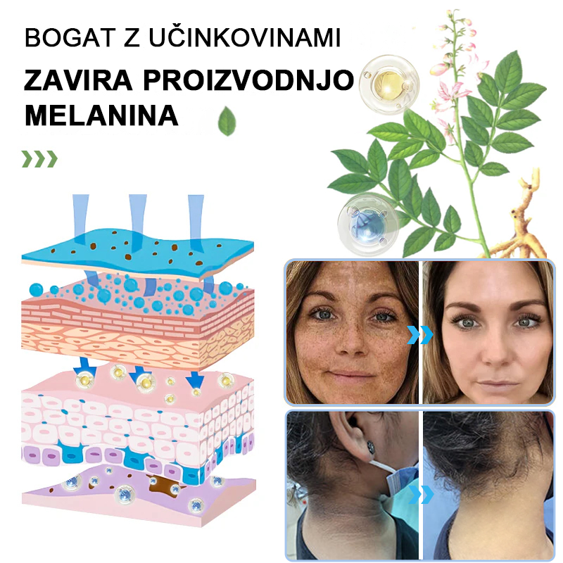 Čistilni piling gel za Acanthosis Nigricans, luščenje, temne madeže, kožne oznake in ekceme