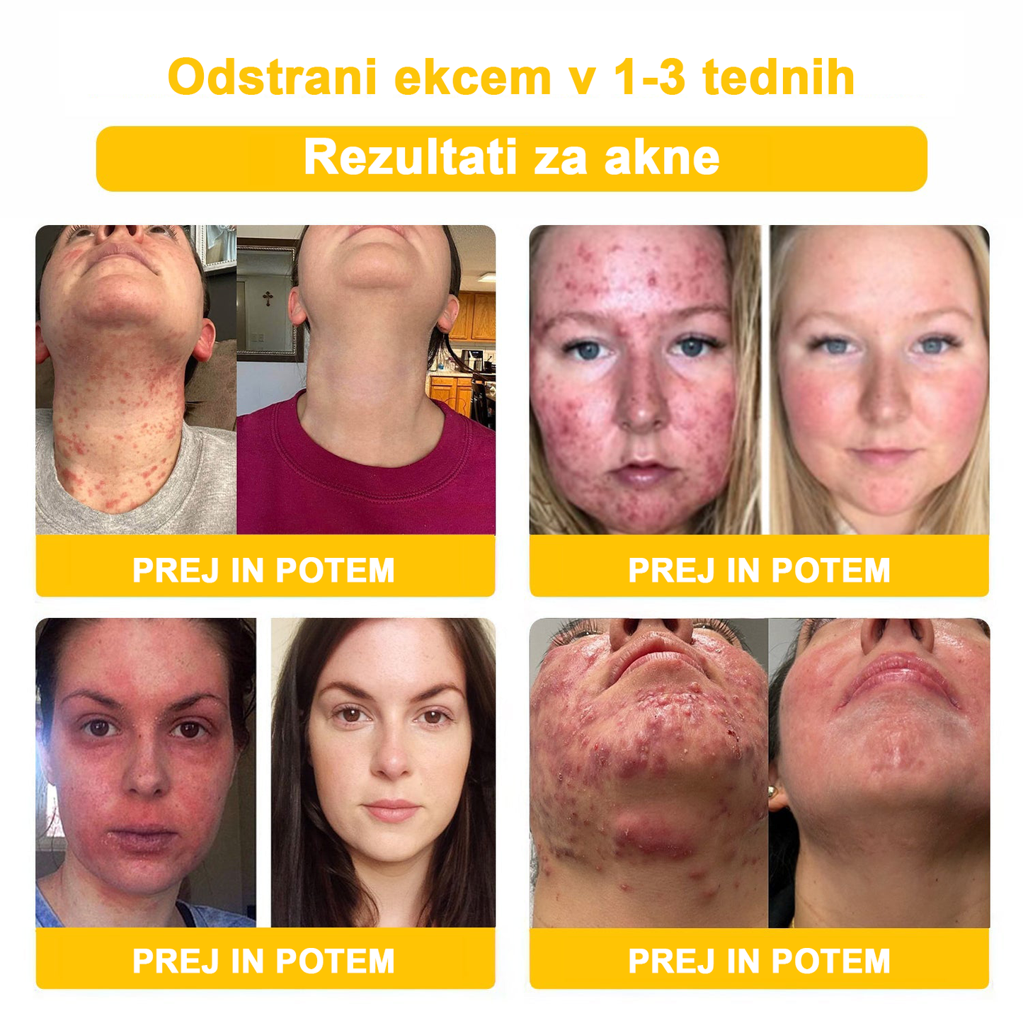 𝑽𝒆𝒍𝒊𝒔𝒔𝒆™ 2024 (priporoča AAD), za odstranjevanje bradavic, aken in brazgotin. Zdravi različne kožne bolezni