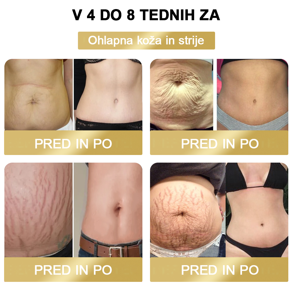 🔥80 % popusta 🌿 ZVLZVL™ obliž za limfno drenažo s čebeljim strupom (primeren za ljudi vseh starosti)