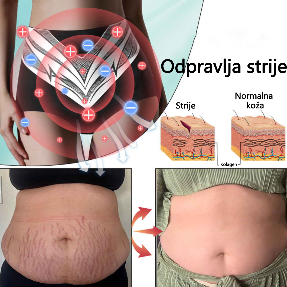 🎉 Časovno omejena ponudba – Velik popust! 💰 Anyidea™ samoregulirajoče kratke hlače iz turmalina s titanovimi vlakni