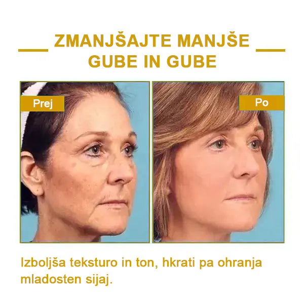 🌿𝐅𝐮𝐛𝐬𝐭𝐚® pomlajevalno olje za učvrstitev kože🩵 Zadnji dan popusta: 75 % CENEJE💧