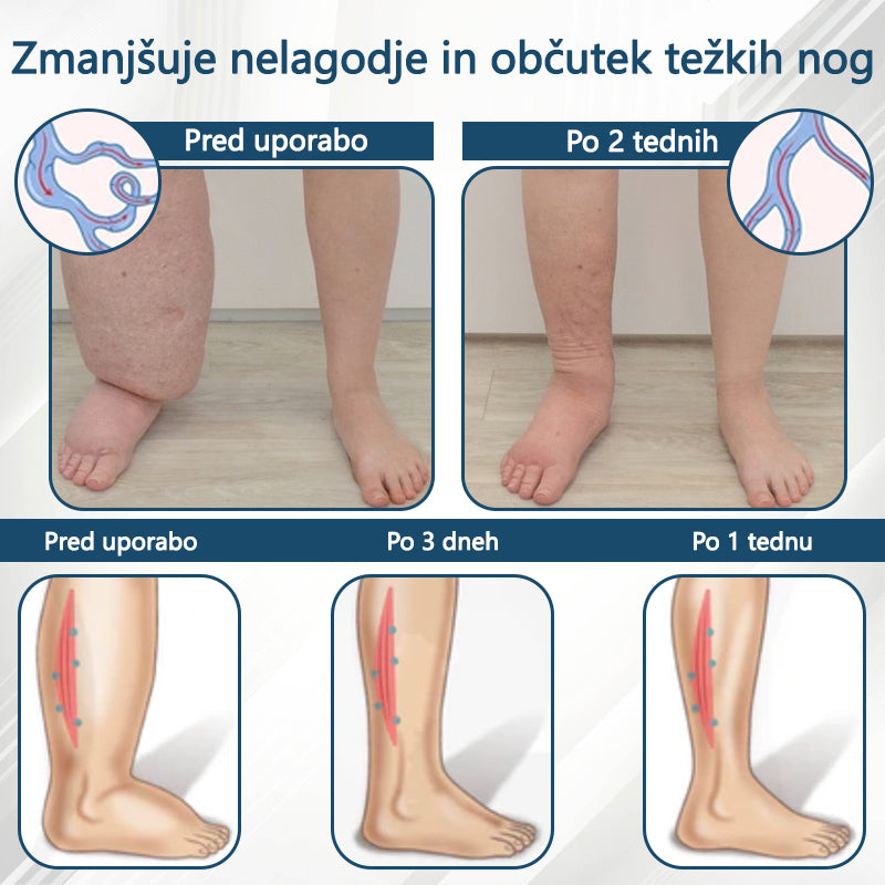 ATTDX® Črni kumen – zeliščna krema za pomiritev oteklin 🌿🦵