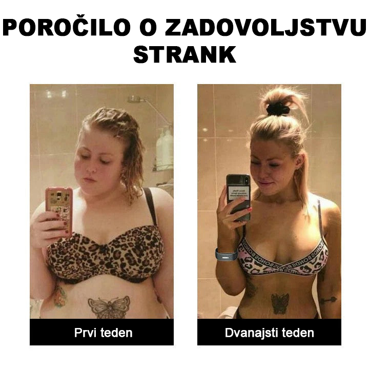 🥑𝐉𝐎𝐒𝐅𝑰𝐓™ Ultrazvočni trakovi za odstranjevanje maščobe
