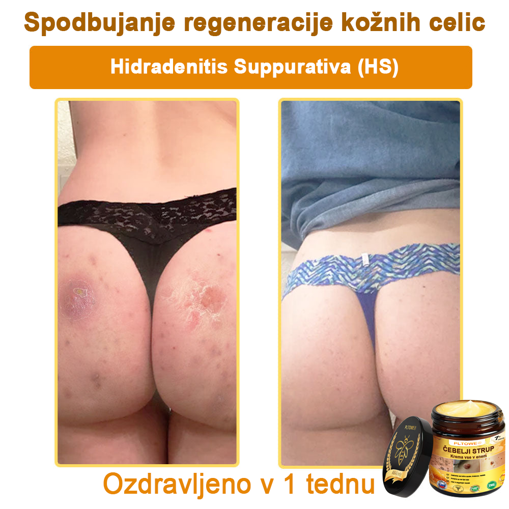 ZADNJA PRILOŽNOST! Zgrabi to srečno najdbo s 70 % Popustom! 🔥180-DNEVNO GARANCIJA VRAČILA DENARJA!