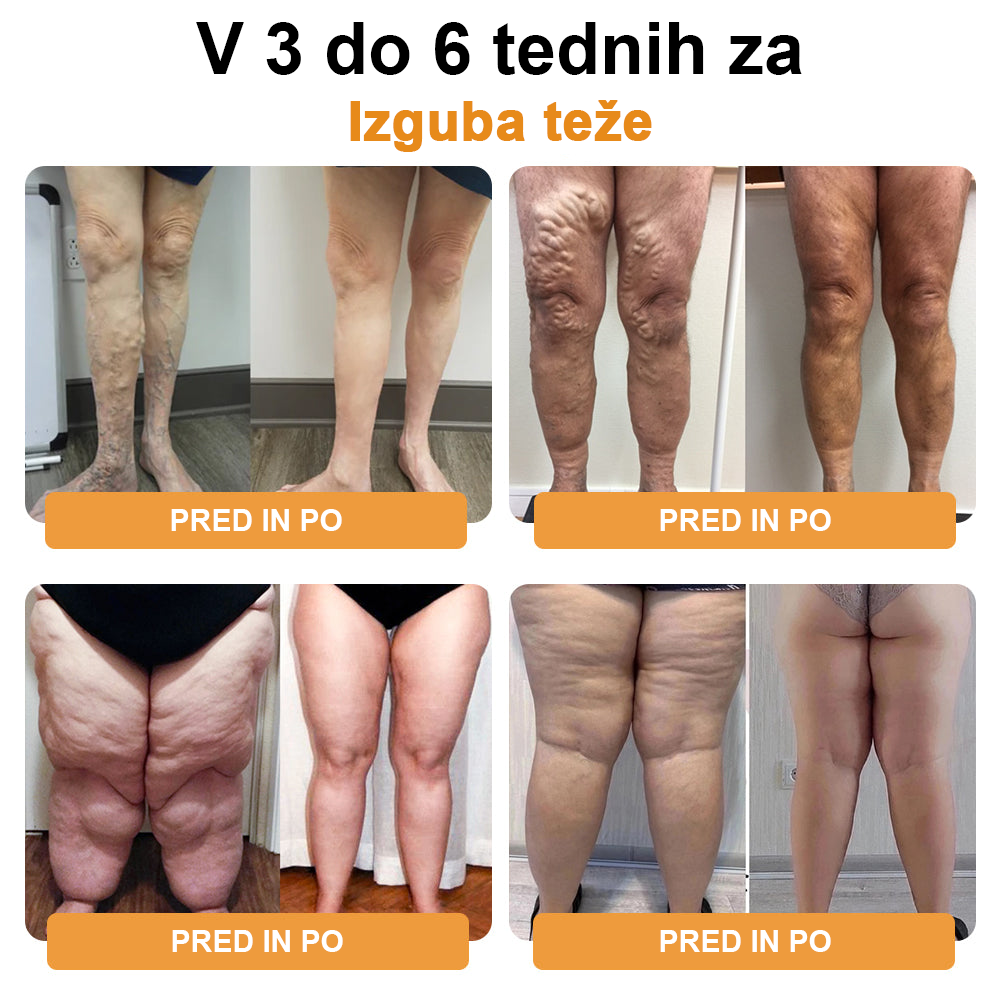 🐝𝙇𝙪𝙠𝙢𝙡𝙘𝙖™ kroglice za limfno drenažo s čebeljim strupom in namakanje stopal🫚