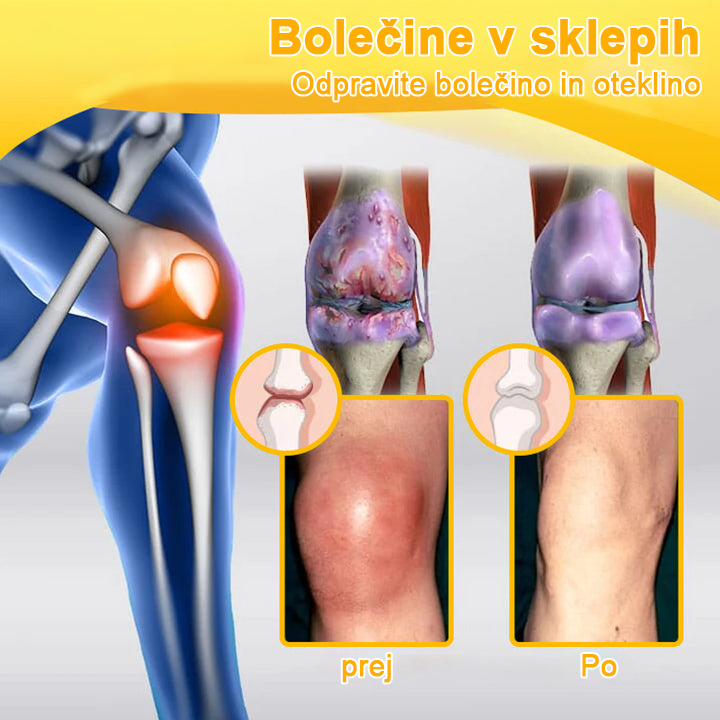 👩⚕️👩⚕️𝐀ее𝐡𝐟𝐧𝐠™ Krema s čebeljim strupom za napredno terapijo sklepov in kosti (izvleček novozelandske čebele - specializirano za ortopedske in artritisne bolečine)