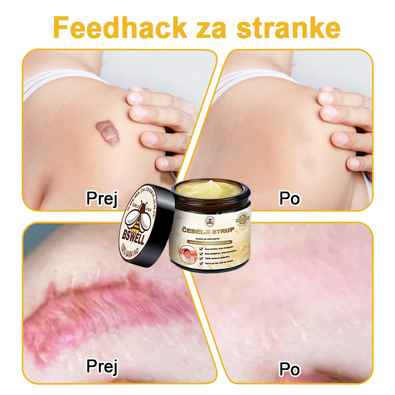 🐝✨𝑩𝑺𝑾𝑬𝑳𝑳® Krema za nego kože z čebeljim strupom👨⚕️ (Priporočena s strani AAD) (🔥 Zadnji dan promocije, prihranite 70%)