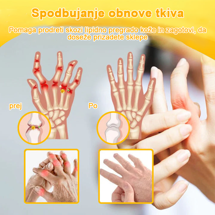 👩⚕️👩⚕️𝐀ее𝐡𝐟𝐧𝐠™ Krema s čebeljim strupom za napredno terapijo sklepov in kosti (izvleček novozelandske čebele - specializirano za ortopedske in artritisne bolečine)