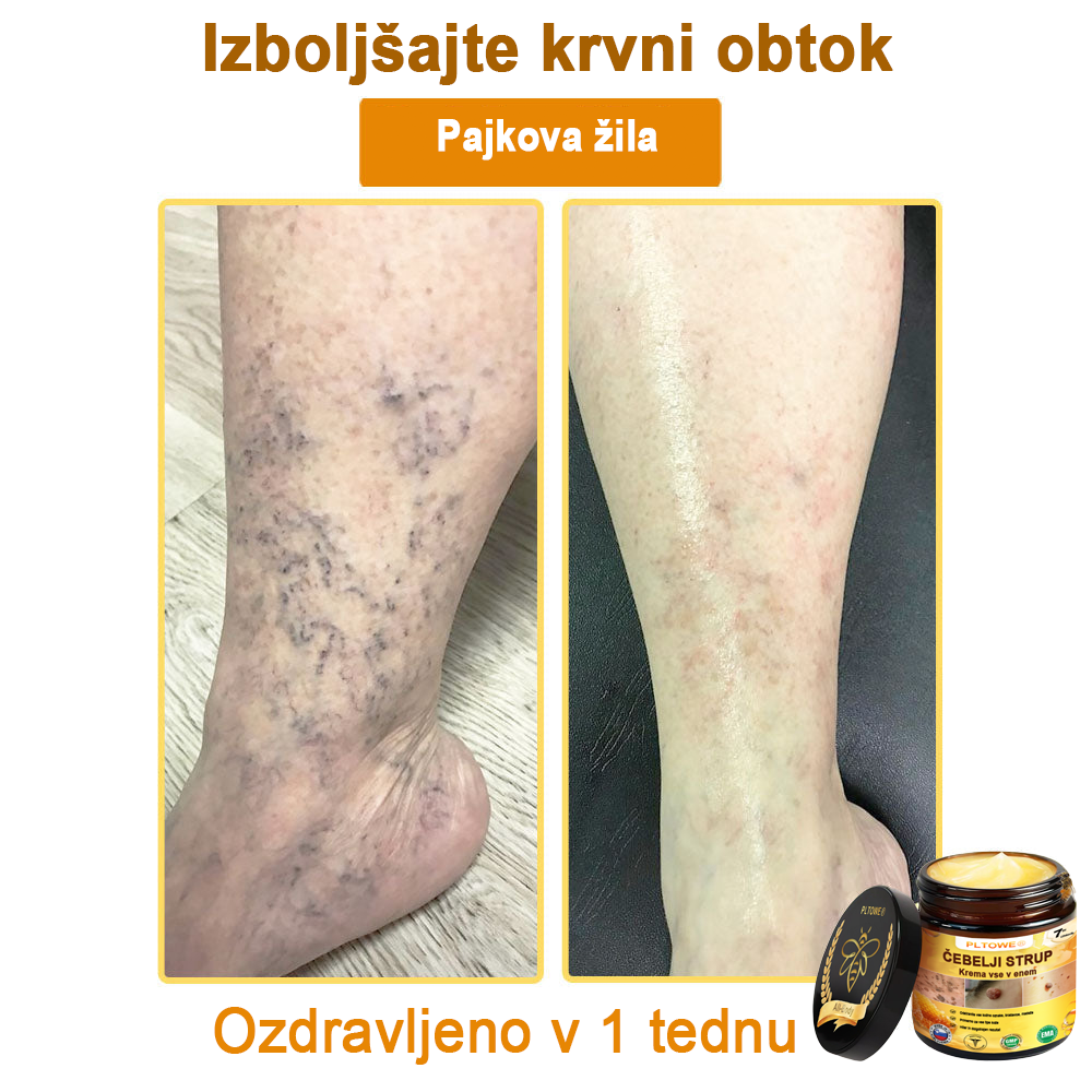 ZADNJA PRILOŽNOST! Zgrabi to srečno najdbo s 70 % Popustom! 🔥180-DNEVNO GARANCIJA VRAČILA DENARJA!