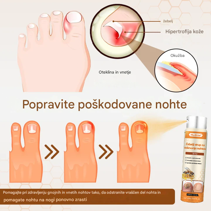 💥 2025 Omejeno 70 % CENEJE ️⏳ Ceoerty® NailRescue Kolirin pršilo proti glivicam s čebeljim strupom 💥 Vse težave z nohti lahko pozdravite v 2 tednih