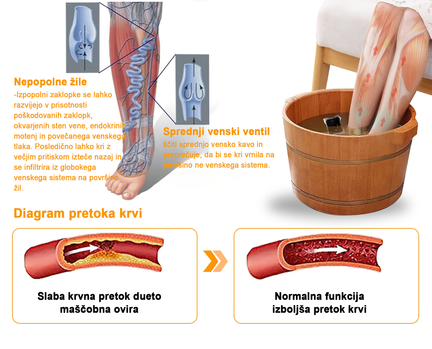 𝐀𝐞𝐞𝐡𝐟𝐞𝐧𝐠™ 𝐙𝐞𝐥𝐢šč𝐧𝐞 𝐫𝐚𝐳𝐬𝐭𝐫𝐮𝐩𝐥𝐣𝐞𝐯𝐚𝐥𝐧𝐞 𝐤𝐫𝐨𝐠𝐥𝐢𝐜𝐞 𝐳𝐚 𝐯𝐞𝐧𝐞 𝐳𝐚 𝐤𝐨𝐩𝐞𝐥 𝐧𝐨𝐠🦵👩⚕️ (LANA Certification, European Lymphology Association)