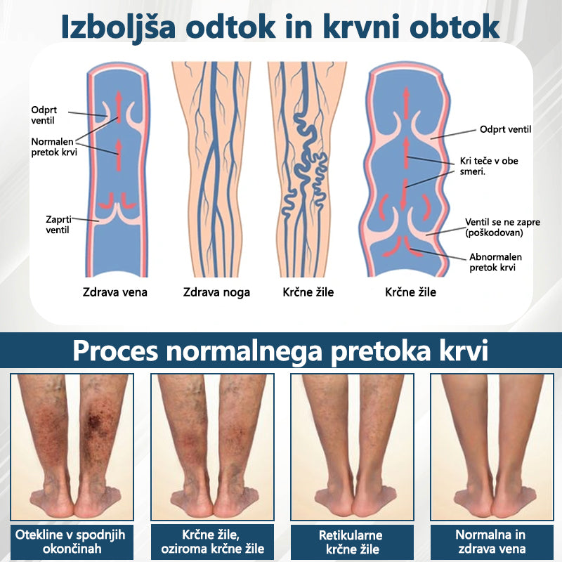 ATTDX® Črni kumen – zeliščna krema za pomiritev oteklin 🌿🦵