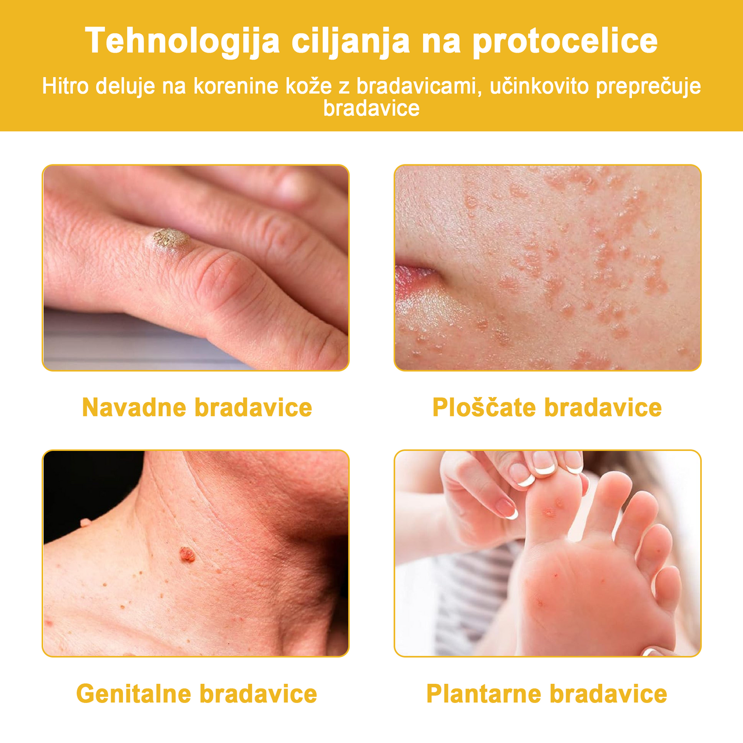 🐝✨𝑩𝑺𝑾𝑬𝑳𝑳® Krema za nego kože z čebeljim strupom👨⚕️ (Priporočena s strani AAD) (🔥 Zadnji dan promocije, prihranite 70%)