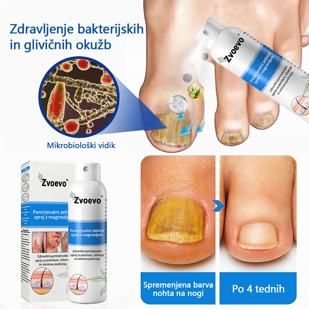 ✅ Uradna trgovina: Zvoevo® Magnezijev zeliščni sprej za luskavico ⚕️ EMA certificirano (lajša luskavico in ekcem, izboljšuje bakterijske okužbe na genitalnem področju, zdravi akne in bradavice, lajša bolečine v sklepih in nevropatske bolečine)