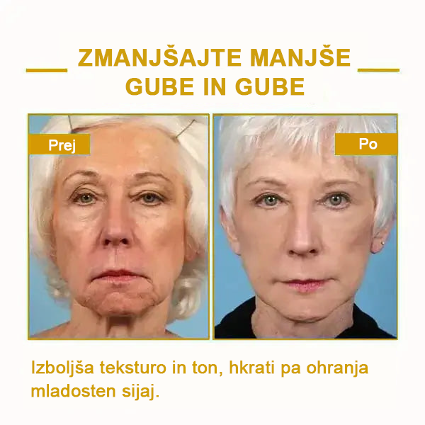 🌿𝐅𝐮𝐛𝐬𝐭𝐚® pomlajevalno olje za učvrstitev kože🩵 Zadnji dan popusta: 75 % CENEJE💧