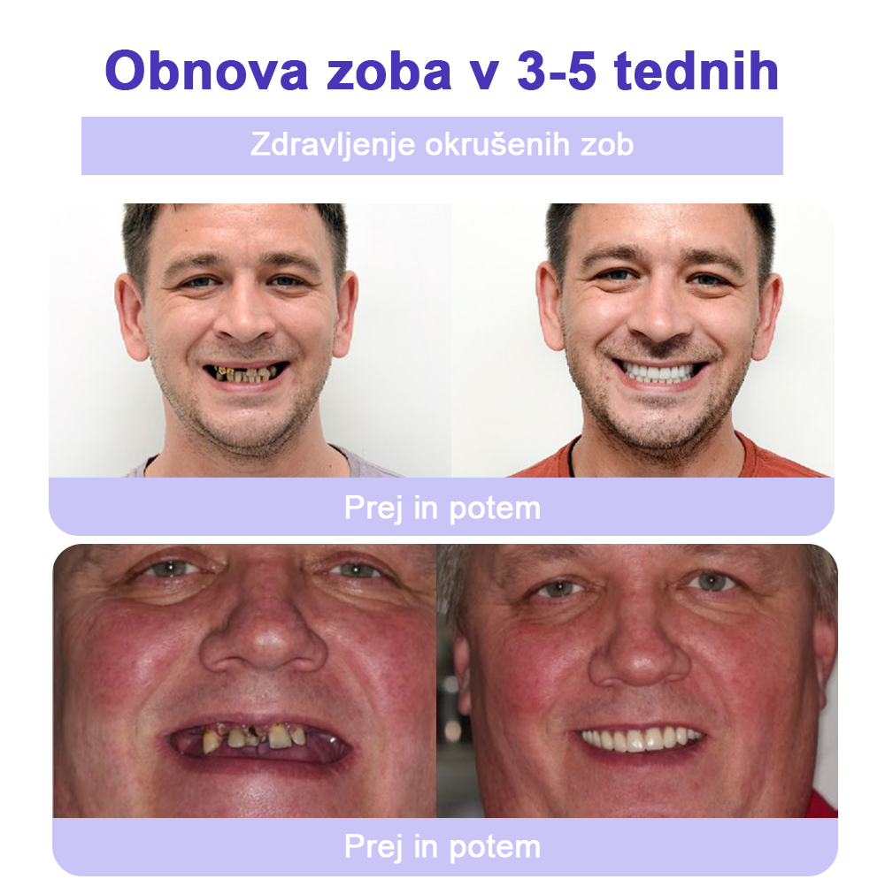GarageLine™ (priporočeno s strani ADA) Prah za obnovo zobne sklenine (⏰𝐋𝐢𝐦𝐢𝐭𝐚𝐧𝐨 𝐝𝐨𝐥𝐝𝐚𝐧𝐣𝐚 𝐿𝐚𝐬𝐭 𝟑𝟎 𝐦𝐢𝐧𝐮𝐭) 🪥🦷