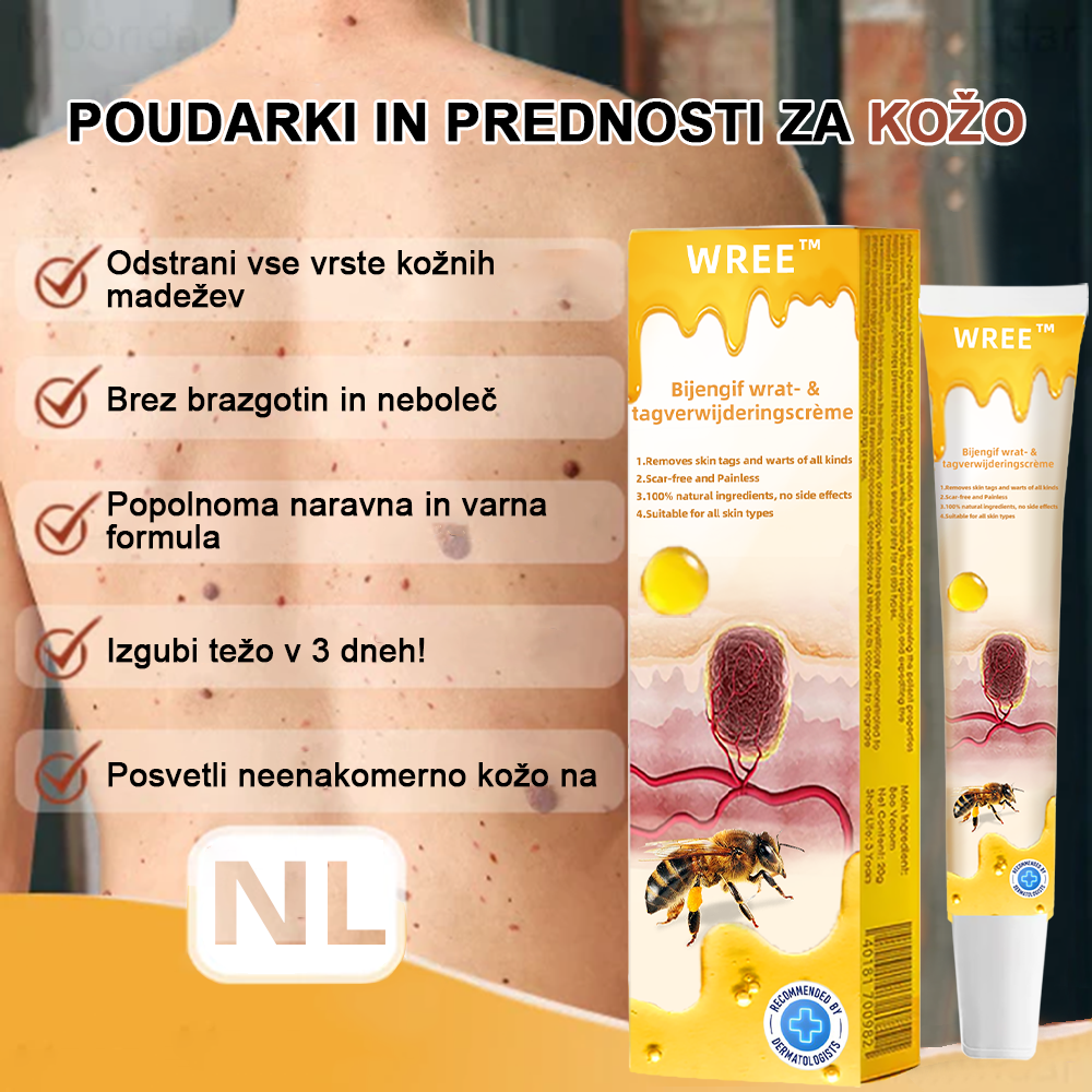 🌺𝙒𝙍𝙀𝙀™ Krema za odstranjevanje bradavic in oznak s čebeljim strupom (👨⚕Primerna za vse tipe kože)🐝(🔥Promocija zadnji dan 70% popust)