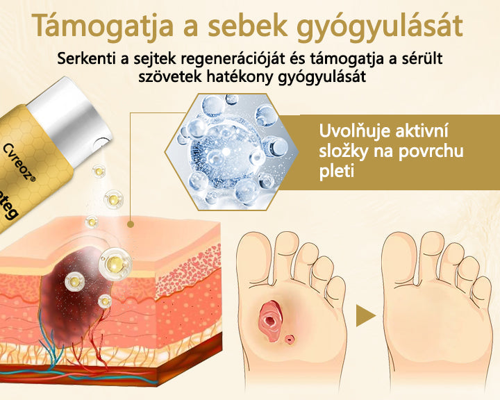 Cvreoz® čebelji strup v zdravilnem pršilu za celjenje in obnovo ran na rokah in nogah ⭐️