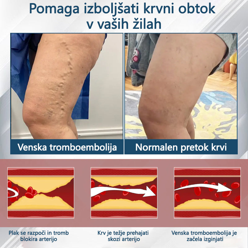 ATTDX® Črni kumen – zeliščna krema za pomiritev oteklin 🌿🦵