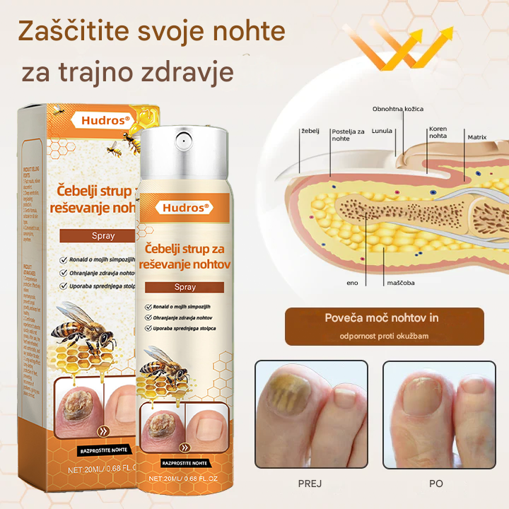 💥 2025 Omejeno 70 % CENEJE ️⏳ Ceoerty® NailRescue Kolirin pršilo proti glivicam s čebeljim strupom 💥 Vse težave z nohti lahko pozdravite v 2 tednih