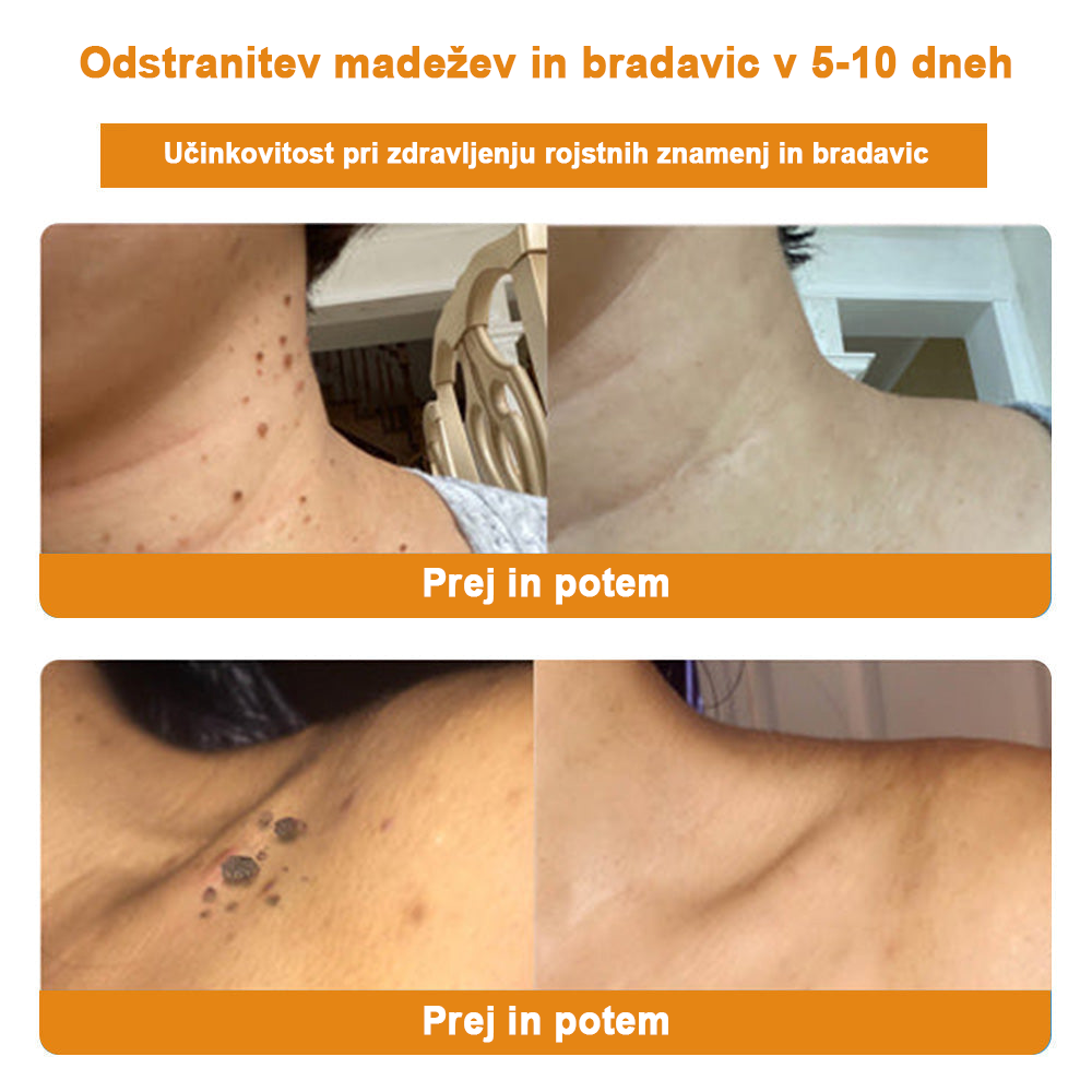 🐝✨𝑩𝑺𝑾𝑬𝑳𝑳® Krema za nego kože z čebeljim strupom👨⚕️ (Priporočena s strani AAD) (🔥 Zadnji dan promocije, prihranite 70%)