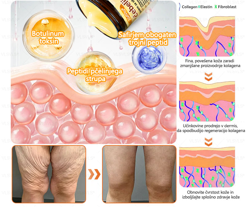 💟 Dermatologi priporočajo ✨ ZödVita® obnavljajoča krema z čebeljim strupom 🔥  CE-certifikat in ga priporoča Slovensko dermatološko društvo (SDD)