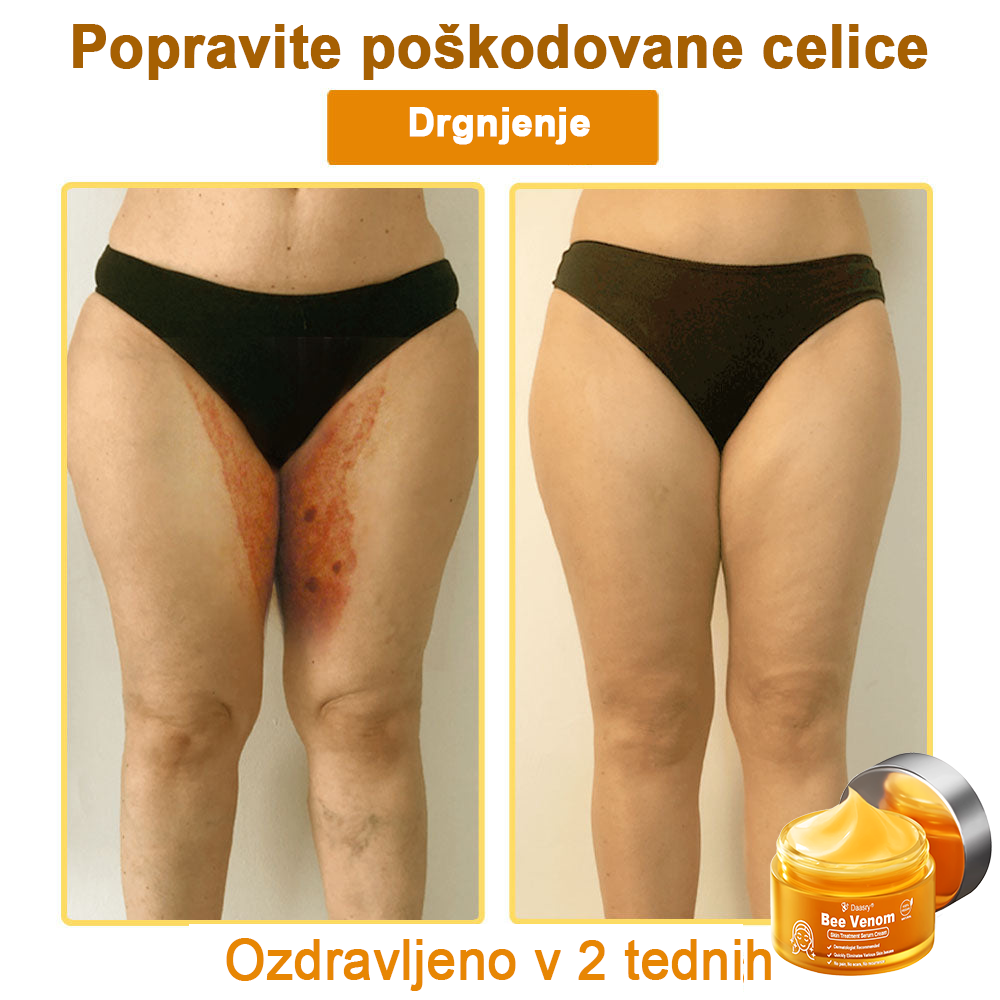 Daasry® Cebelji Strup Kožna Terapija Serum Krema👨⚕️ (Primerno za vse starosti & priporočeno s strani EMA)