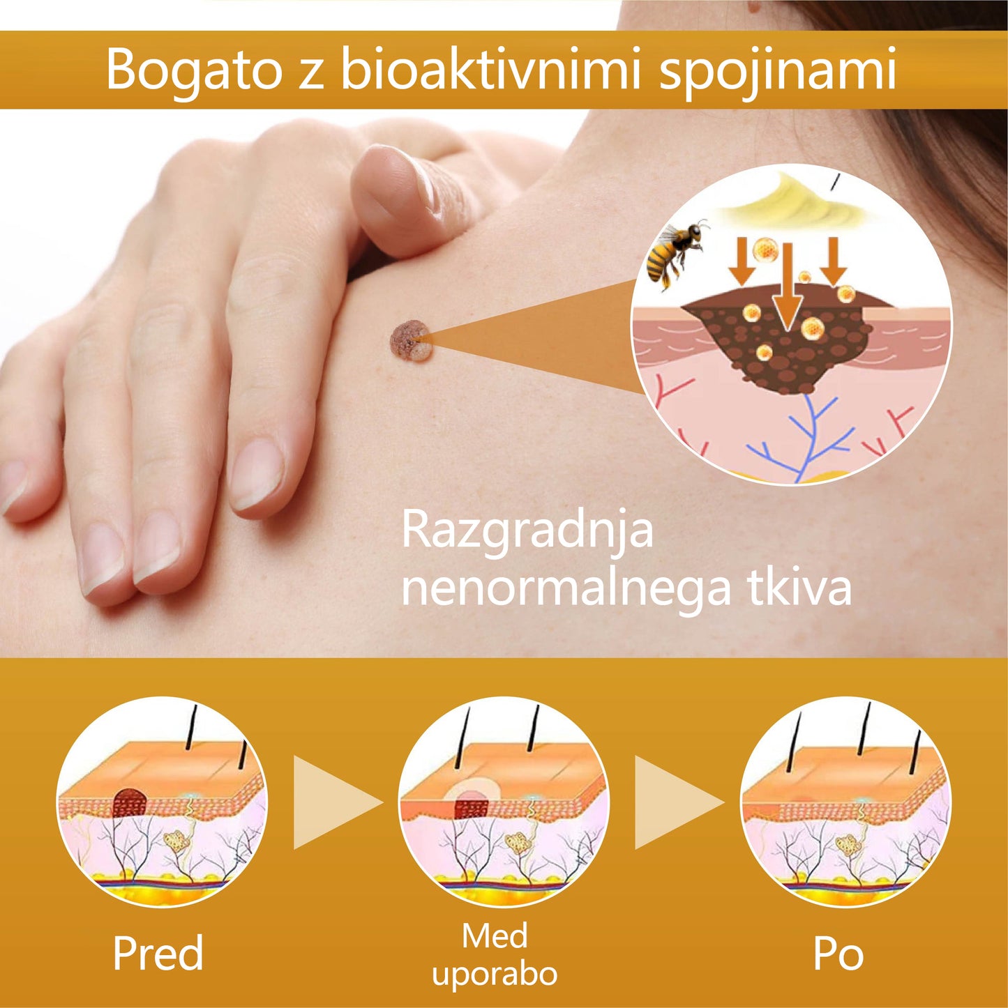 🌟 TOPWAL® Condense Krema za obnovo kože z čebeljim strupom 🌿 Spodbuja regeneracijo kože 💧 Globoko vlaži in neguje ✨ Zmanjšuje drobne gube in linije 🐝 Obogatena z naravnim čebeljim strupom ✔️ Primerna za vse tipe kože, tudi občutljivo