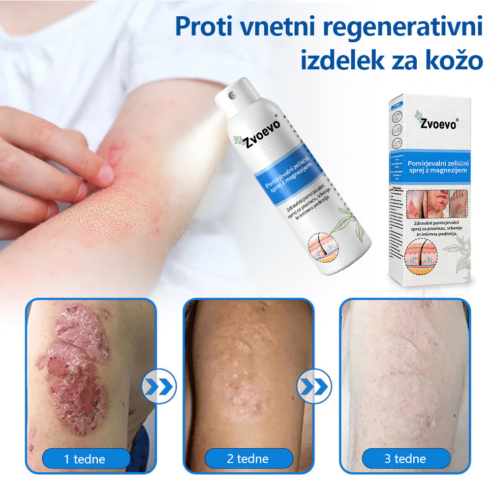 ✅ Uradna trgovina: Zvoevo® Magnezijev zeliščni sprej za luskavico ⚕️ EMA certificirano (lajša luskavico in ekcem, izboljšuje bakterijske okužbe na genitalnem področju, zdravi akne in bradavice, lajša bolečine v sklepih in nevropatske bolečine)