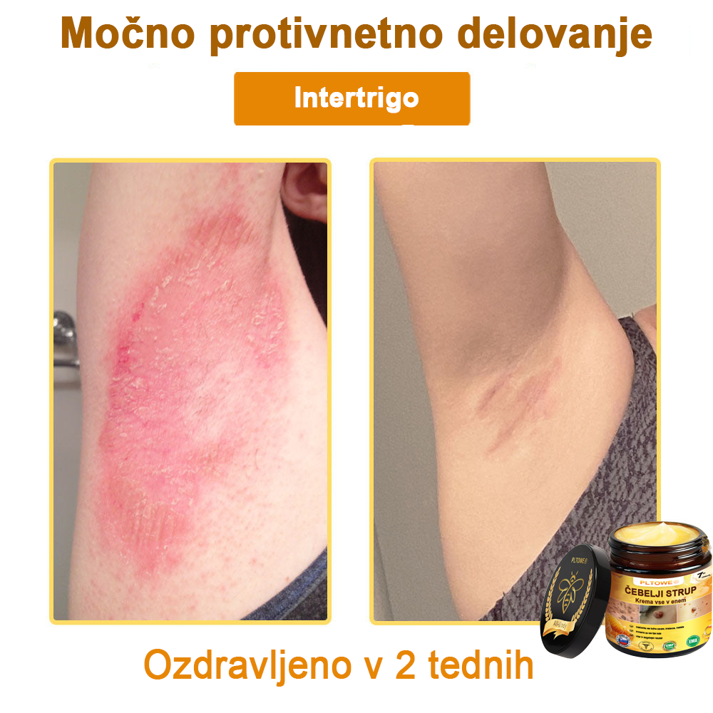 ZADNJA PRILOŽNOST! Zgrabi to srečno najdbo s 70 % Popustom! 🔥180-DNEVNO GARANCIJA VRAČILA DENARJA!