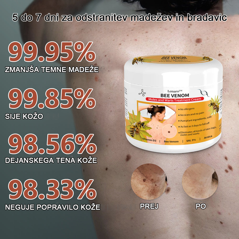 🐝 Krema Lenaro™ za zdravljenje madežev in bradavic 💎💎💎Primerna za vse starostne kategorije🐝