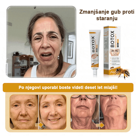 🍀 Zadnji dan promocije: 83 % popust ✨𝐅𝐮𝐫𝐳𝐞𝐫𝐨™ Kremni odstranjevalec gub z čebeljim strupom in botoks učinkom🐝