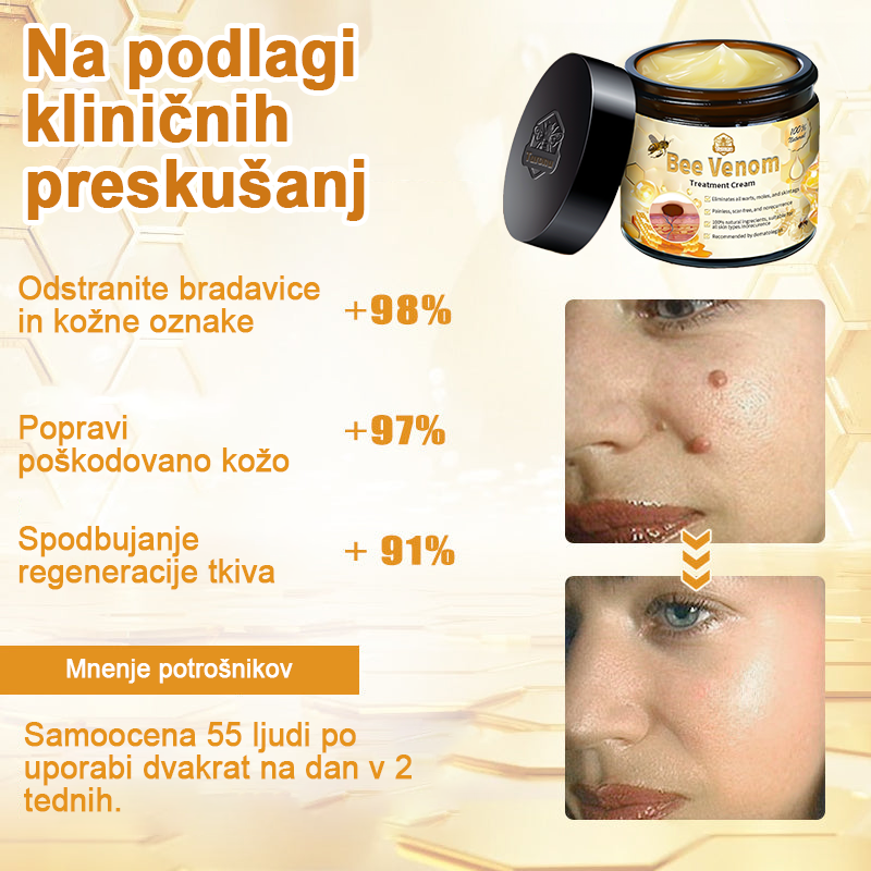 🍊𝑻𝒖𝒓𝒐𝒏𝒖™ Zdravilno mazilo s čebeljim strupom (👨⚕𝐀𝐀𝐃 PRIPOROČILA)